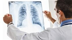 especializacion online infecciones tumores respiratorios
