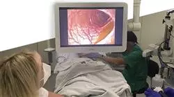 especializacion online endoscopia oncologica via biliar pancreas