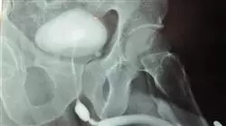 especializacion online cirugia urologica hombre