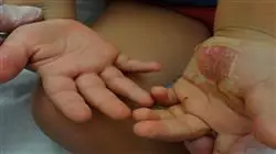 ##IMAGE##