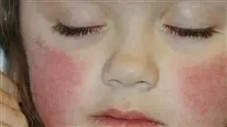 ##IMAGE##