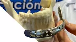 ##IMAGE##