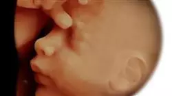 ##IMAGE##