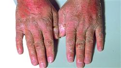 experto ndocrinologia hueso lipidos