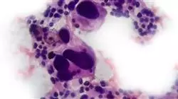 ##IMAGE##