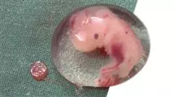 ##IMAGE##