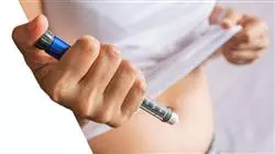 ##IMAGE##
