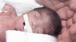 ##IMAGE##