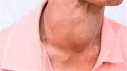 ##IMAGE##