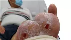 ##IMAGE##