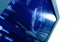 ##IMAGE##