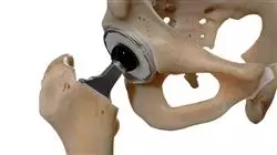 ##IMAGE##