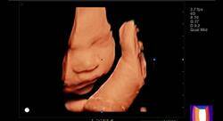 diplomado radiología diagnóstica ginecológica y de mama