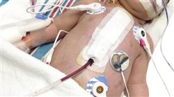 cursos cirugia cardiopatias congenitas