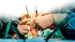 especializacion cirugia coronaria