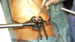 especializacion online cirugia aorta
