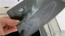 ##IMAGE##