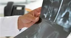 diplomado online avances en técnicas y materiales en radiología intervencionista