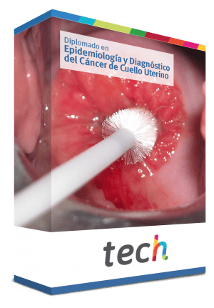 diplomado epidemiologia diagnostico cancer cuello uterino caja
