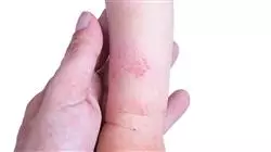 ##IMAGE##