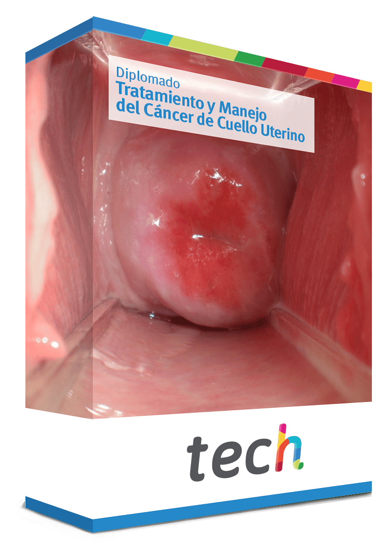 diplomado tratamiento manejo cancer cuello uterino caja