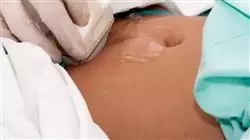 ##IMAGE##