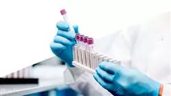 ##IMAGE##