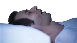 ##IMAGE##