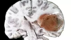 ##IMAGE##