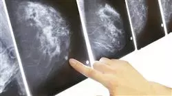 ##IMAGE##