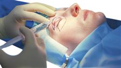 especializacion online patologia palpebral oculoplastia orbita vias lagrimales