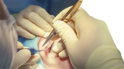 experto patologia palpebral oculoplastia orbita vias lagrimales