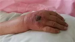 ##IMAGE##