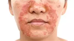 ##IMAGE##