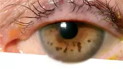 ##IMAGE##