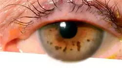 ##IMAGE##