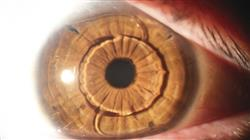 magister semipresencial tecnologias opticas optometria clinica
