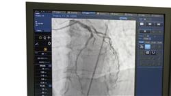 formacion evaluacion prehospitalaria sindrome coronario agudo