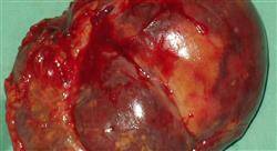 curso patología quirúrgica renal
