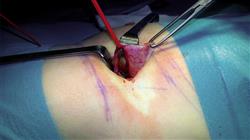 formacion patologia quirurgica renal