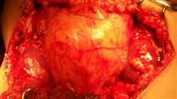 posgrado patologia quirurgica renal