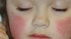 ##IMAGE##