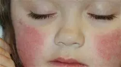 ##IMAGE##