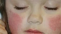 ##IMAGE##