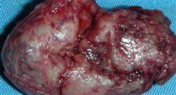 curso cirugía vascular renal