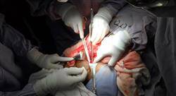 formacion cirugía vascular renal