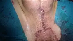 ##IMAGE##