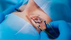 cursos cirugia oftalmological