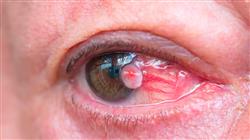 especializacion patologias oculares diagnostico terapeutica
