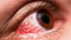experto patologias oculares diagnostico terapeutica